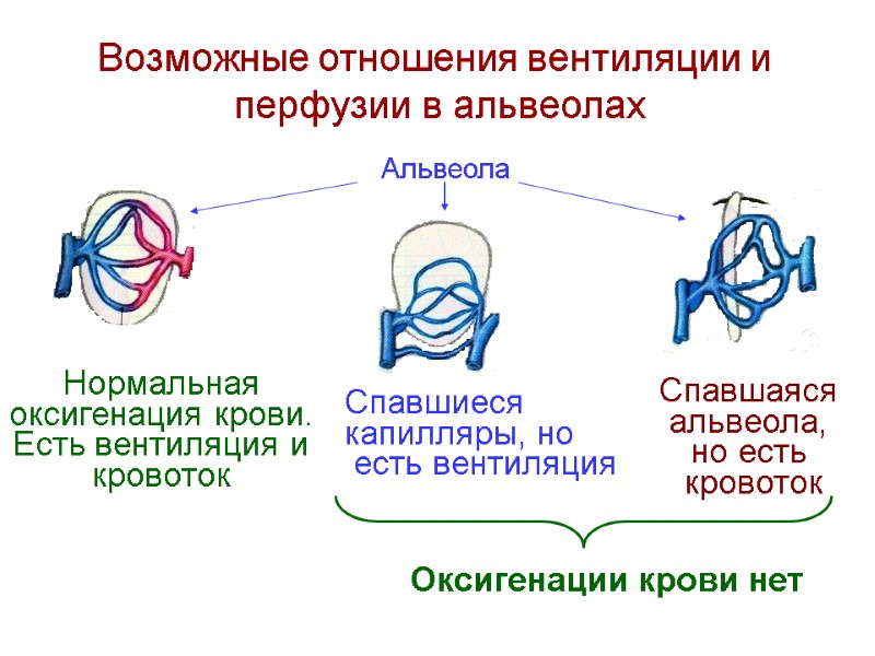 Возможные отношения вентиляции и  перфузии в альвеолах Альвеола Нормальная оксигенация крови. Есть вентиляция